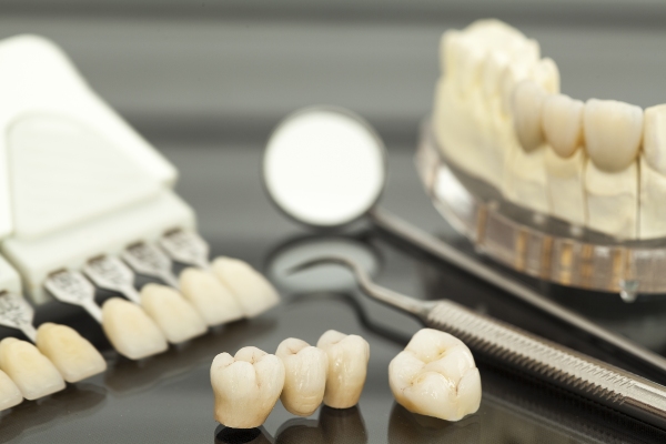 Are Dental Bridges Permanent Restorations?