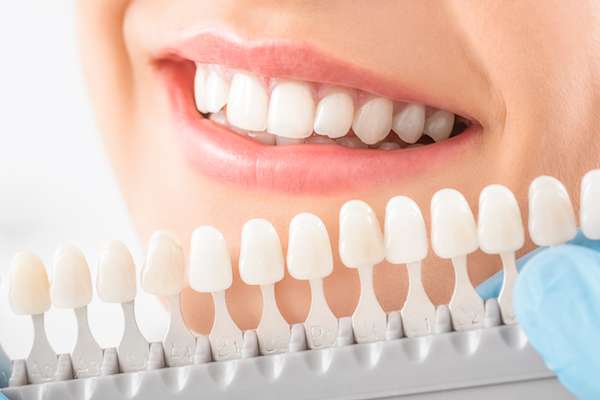 Caring for Veneers After a Cosmetic Dentist Treatment from Chesterfield Dentist in Chester, VA
