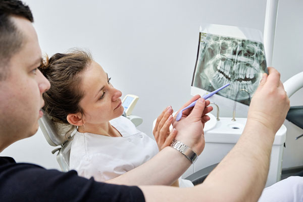 What To Do If You Damage A Dental Filling