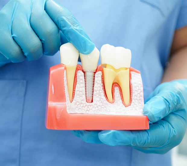 Chester Questions to Ask at Your Dental Implants Consultation
