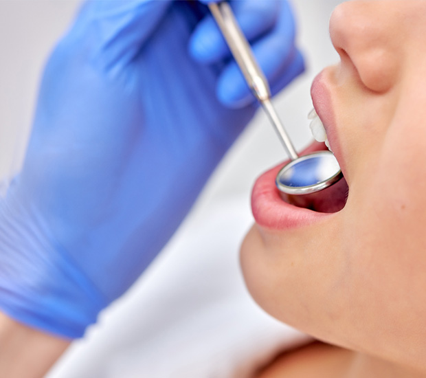 Chester Dental Sealants
