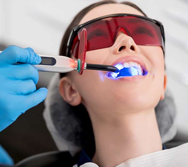 Chester Professional Teeth Whitening