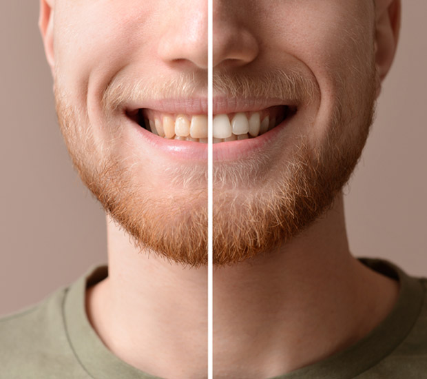 Chester Routine Dental Procedures