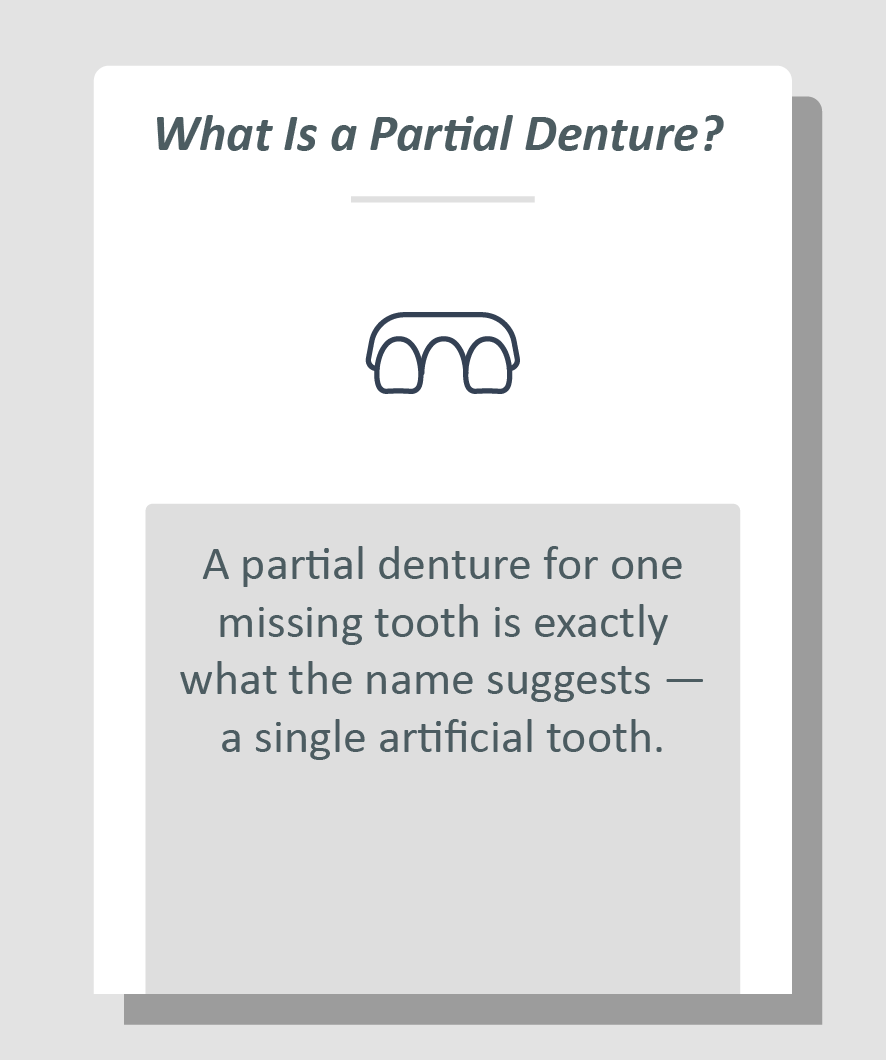 Partial denture for one missing tooth infographic: A partial denture for one missing tooth is exactly what the name suggests - a single artificial tooth.