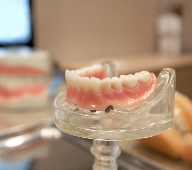 Chester What to Expect When Getting Dentures